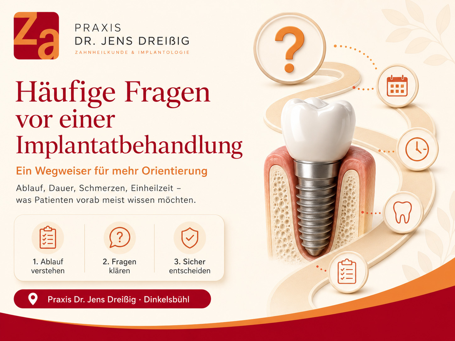 Die häufigsten Fragen vor einer Implantatbehandlung – ein Wegweiser