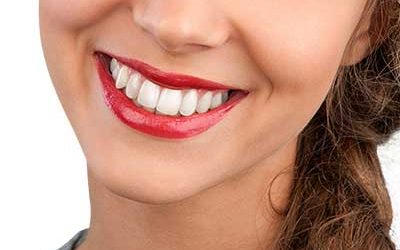 Weiße Zähne – kein Geheimnis und für jeden möglich